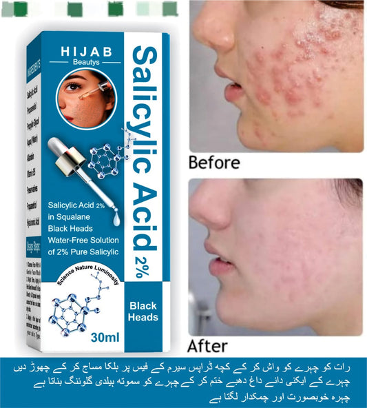 Salicylic Acid 2%